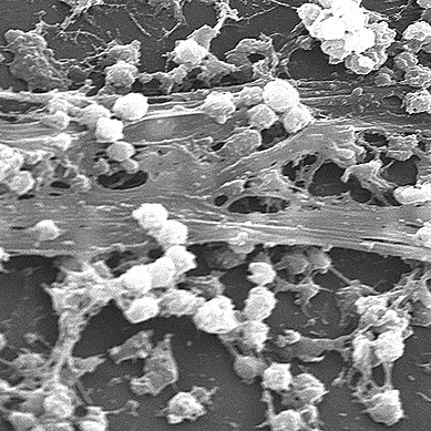 Biofilm